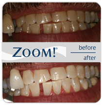 Zoom Before and After photo 5